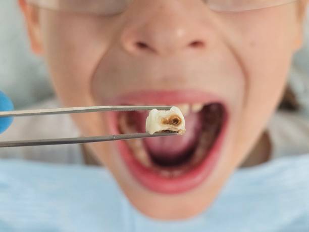 Best Emergency Dentist for Knocked-Out Tooth in Warner, OK